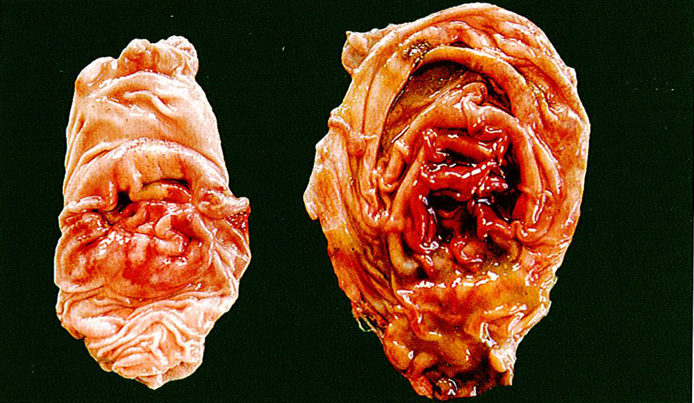 猪传染性胃肠炎病症状图片与彩色图谱-猪肠胃炎病胃底粘膜充血潮红，点状或斑状出血解剖症状图片